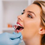 Diastema dentale: definizione e correzione